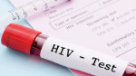 آخرین وضعیت HIV در ایران