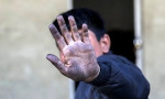 مهم ترین بیماری های کودکان کار؛ از کمردرد تا مشکلات پوستی