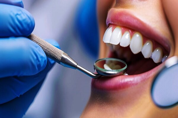 محققان ایرانی روکش دندان را چند ساعته به بیمار تحویل می‌دهند